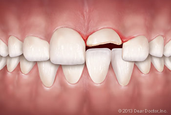 Photo of Facial Trauma