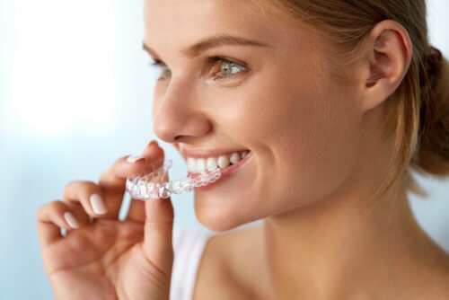 Photo of Mouth Guards