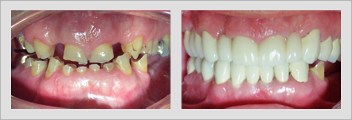 Photo of Before and After 14