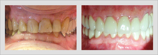 Photo of Before and After 11